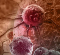 Ученые обнаружили антитело, подавляющее рост раковых опухолей