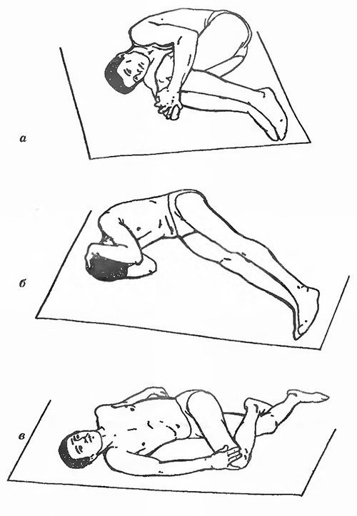 Люмбаго или замороженная спина: упражнения на растяжение мышц