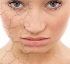 Реанимация лица - новая техника лечения пареза лицевого нерва