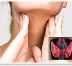 Гипотериоз - народные средства лечения щитовидной железы