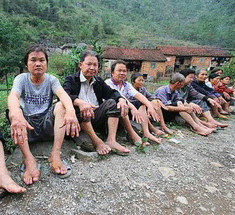 Ученых поставила в тупик болезнь, уродующая деревенских жителей в Китае