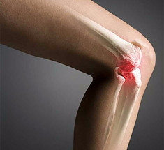 90% болей в коленях связаны не с самим коленом