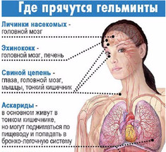 Антипаразитарное Очищение – Личный Опыт