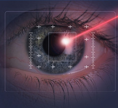 Побочные эффекты лазерной коррекции зрения 