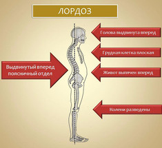 Упражнения для правильной осанки и устранения дефектов костно-мышечной системы
