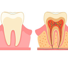 Токсичный зуб: Как можно заболеть из-за корневого канала
