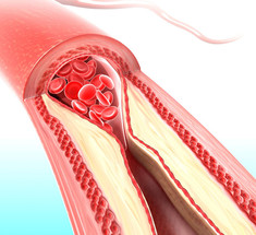 Жесткость артерий – новый мощный показатель риска смерти. Как предотвратить артериальную ригидность