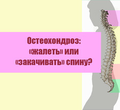Остеохондроз: «жалеть» или «закачивать» спину?