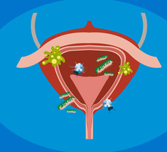 Манноза: купирование цистита и инфекций мочевыводящих путей