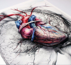 Как не умереть от ишемической болезни сердца
