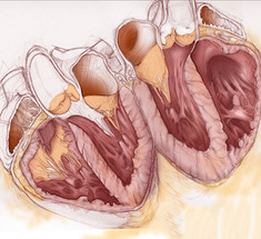 Учащённое сердцебиение: 6 малоизвестных причин проблемы