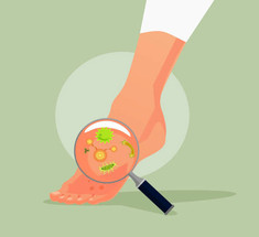 Грибок ногтей: Как победить при помощи уксуса и пищевой соды?