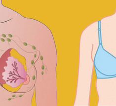 Ношение бюстгальтера и рак груди: в чем связь?