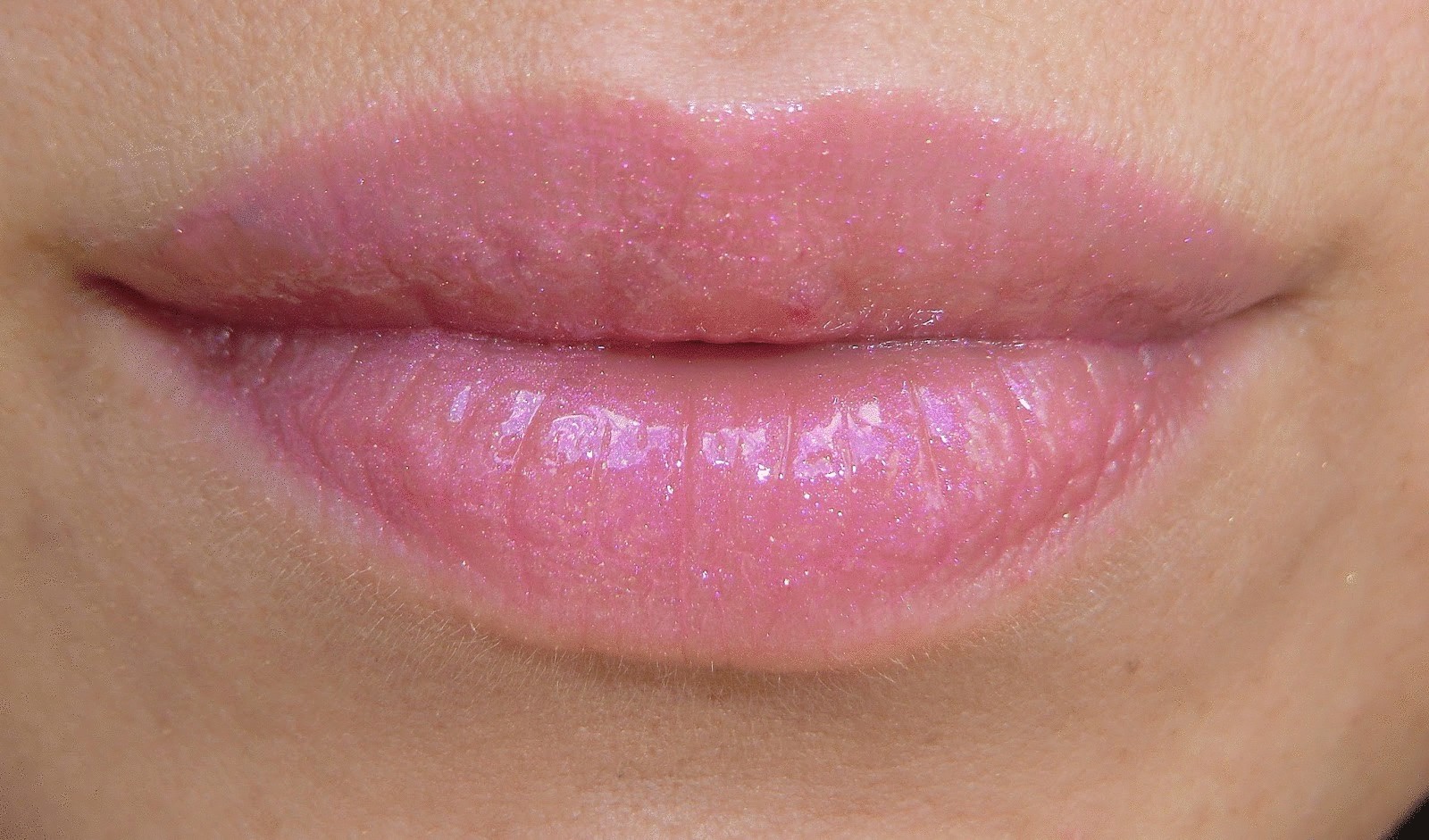 4 способа вылечить обветренные губы