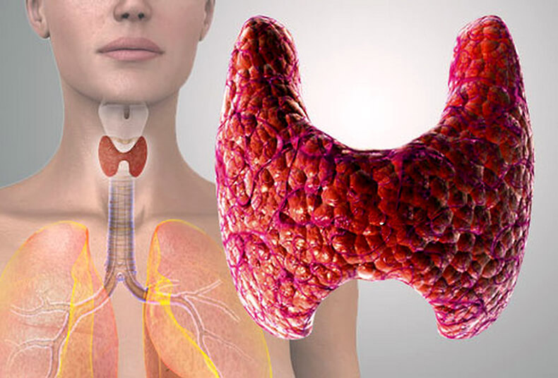 Тупик эндокринологии: Причины заболевания щитовидной железы