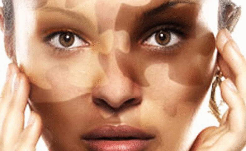 Витилиго— лечение и причины Витилиго— лечение и причины