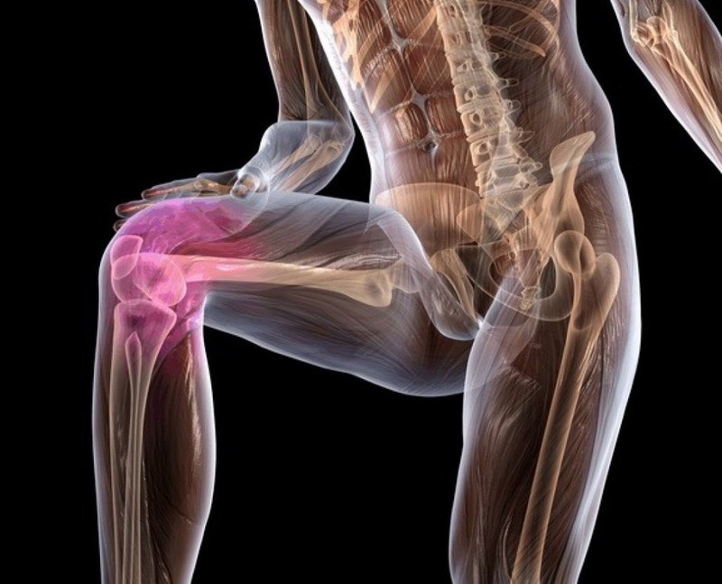 90% болей в коленях связаны не с самим коленом