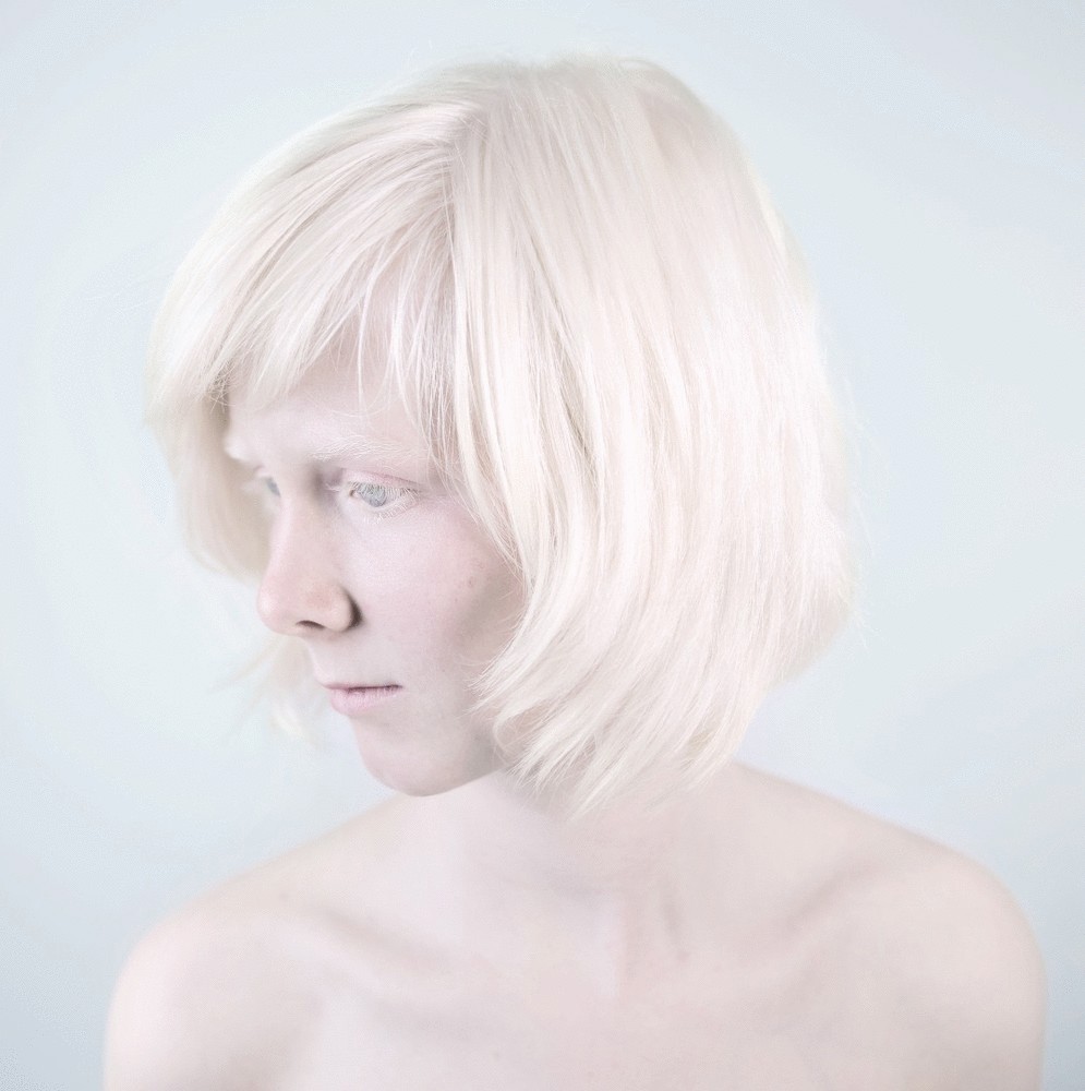 Люди-альбиносы в фотопроекте Сане Де Вайлд 