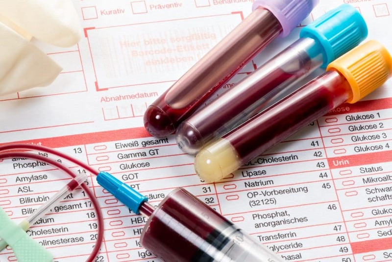 Анализ крови: 9 показателей общего анализа