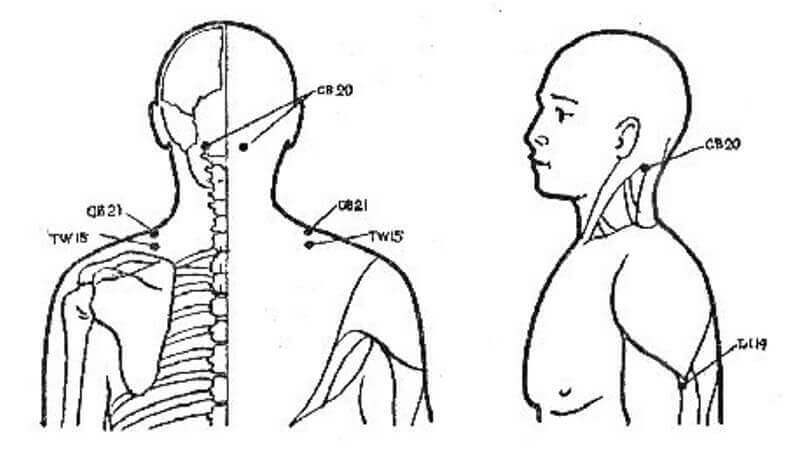 Боли в плечевом суставе: 4 точки, которые вернут подвижность