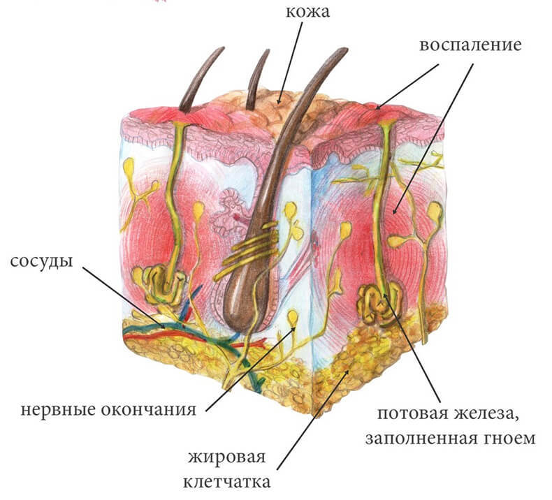 Как зафиксировать компресс под мышкой. content %D1%81%D1%83%D1%87%D1%8C%D0%B5 %D0%B2%D1%8B%D0%BC%D1%8F1 (1). Как зафиксировать компресс под мышкой фото. Как зафиксировать компресс под мышкой-content %D1%81%D1%83%D1%87%D1%8C%D0%B5 %D0%B2%D1%8B%D0%BC%D1%8F1 (1). картинка Как зафиксировать компресс под мышкой. картинка content %D1%81%D1%83%D1%87%D1%8C%D0%B5 %D0%B2%D1%8B%D0%BC%D1%8F1 (1)