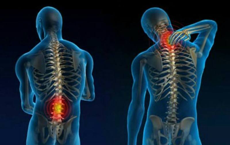 Мифы об остеохондрозе: Что необходимо знать, если болит спина 