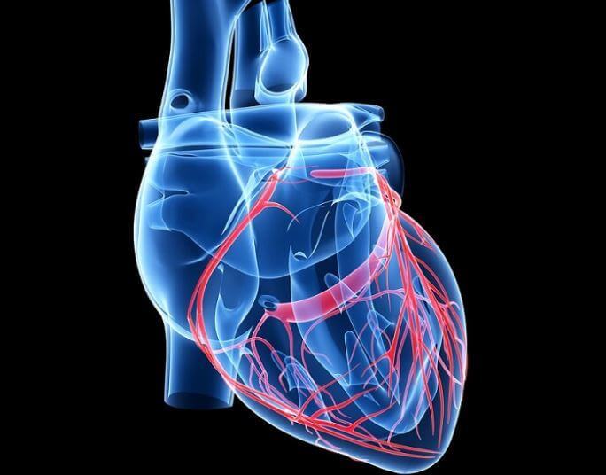 Как предотвратить закупорку коронарных артерий 