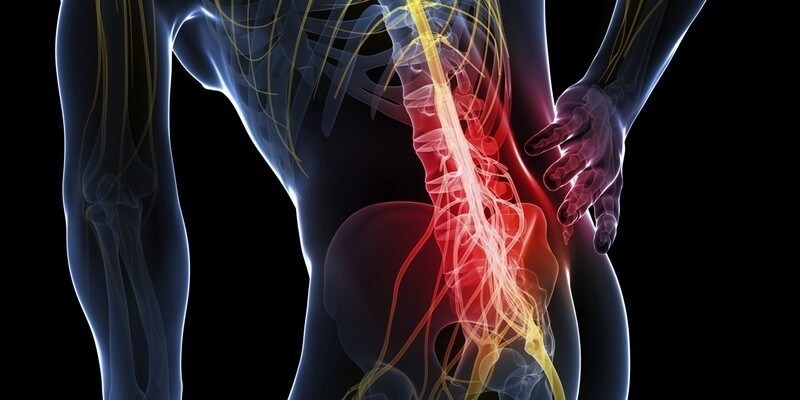 Боль в спине — понимание с позиции современной медицины