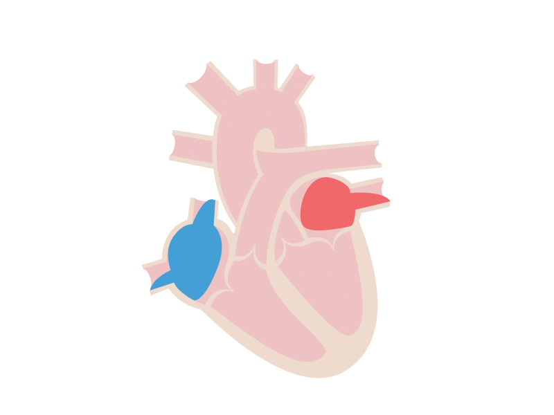 Внезапная остановка сердца: Факторы риска и предвестники