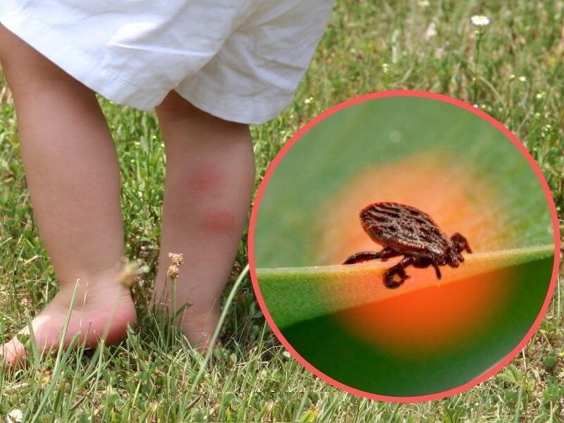 7 укусов насекомых, которые нельзя игнорировать