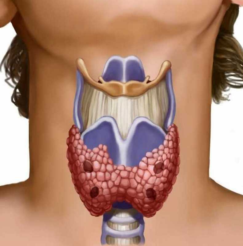Как правильно поддерживать щитовидную железу