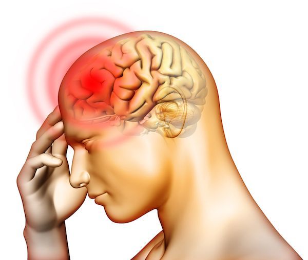 16  простых способов быстро избавиться от головной боли