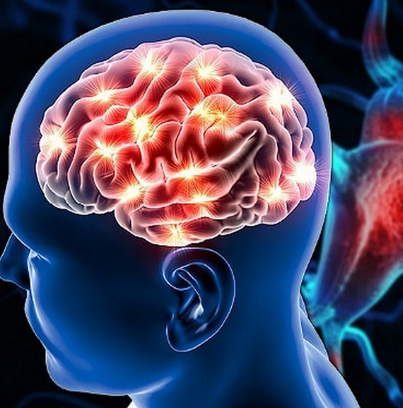 Микроинсульт: как распознать и предотвратить катастрофу мозга