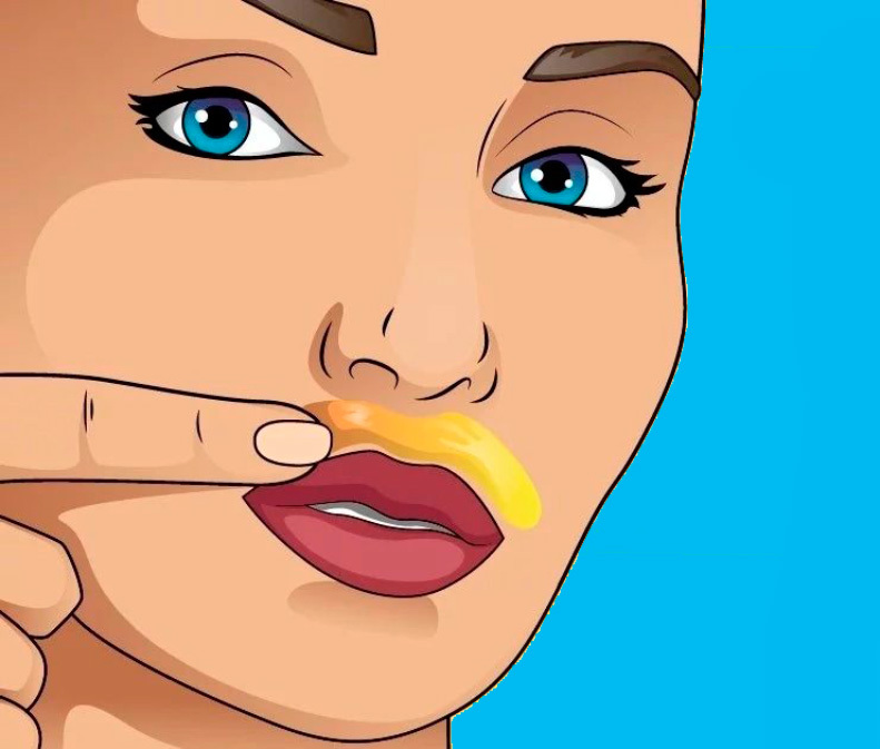 Почему растут усы у женщин 